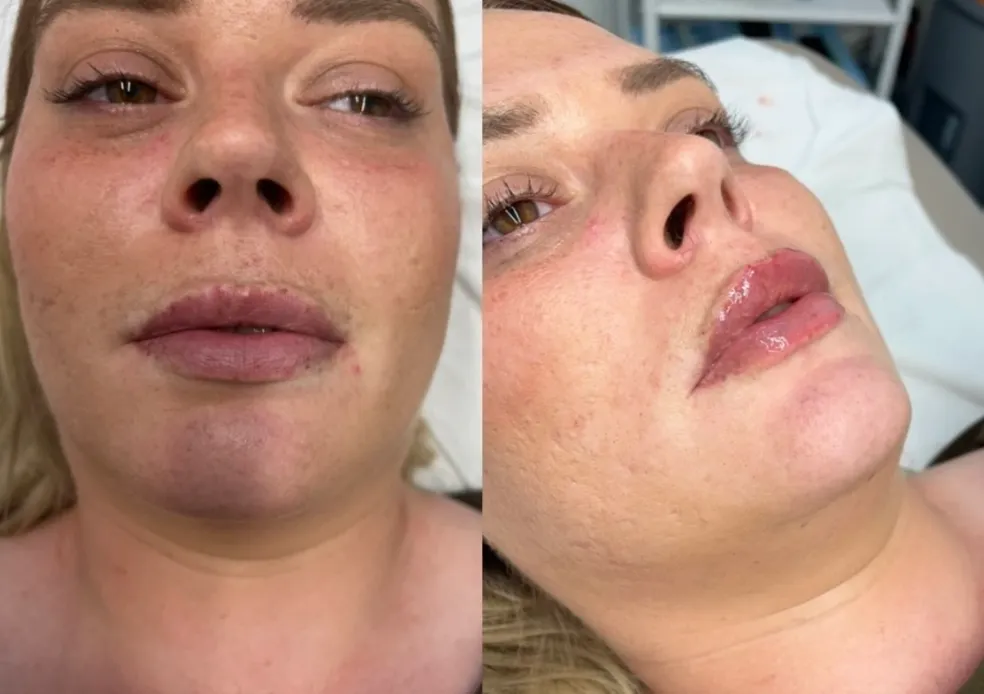 Empire Medical Clinic Botox