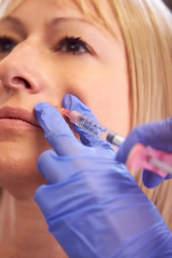 Practitioner injecting dermal filler into the face to restore volume