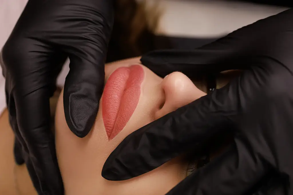 Practitioner injecting dermal filler into the lips using the Russian lips technique