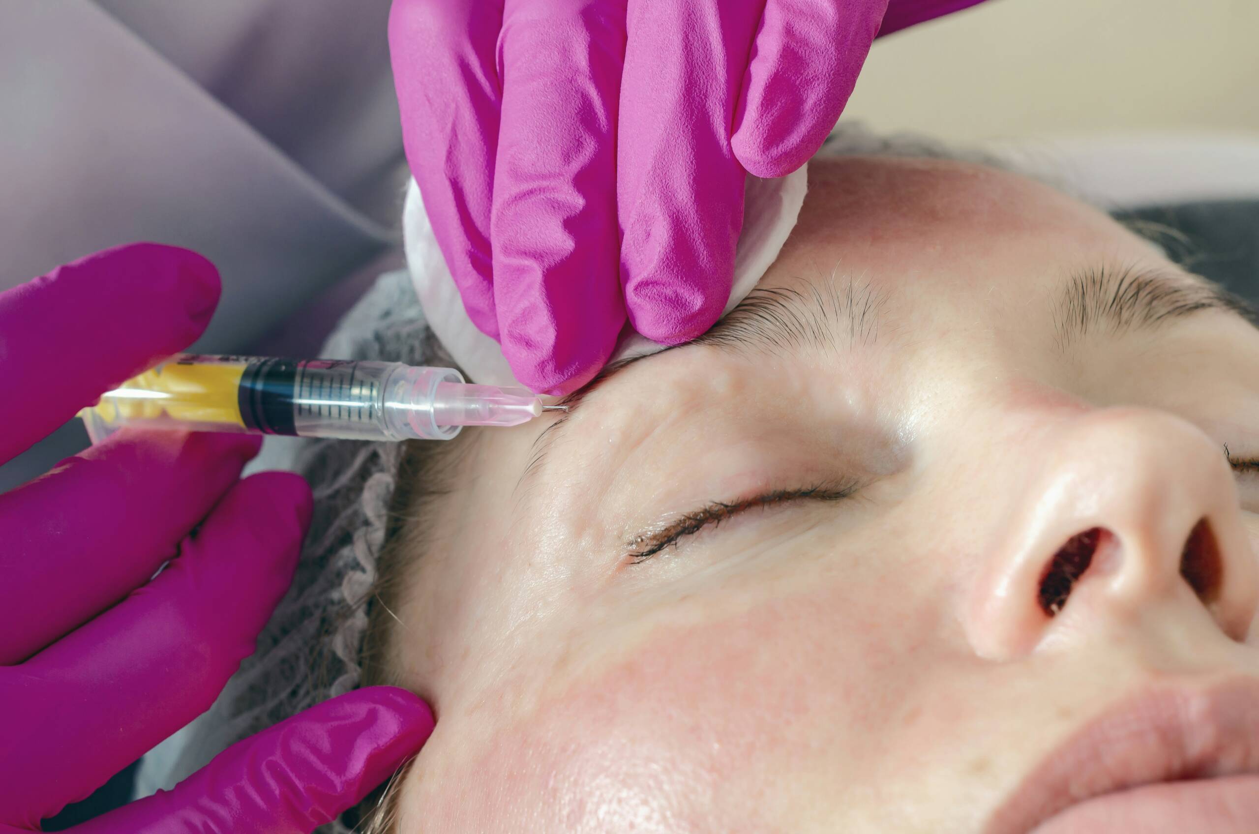 Close-up of a Botox anti-wrinkle injection being administered around the eye area at Empire Medical Clinic, Oldbury